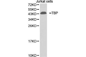 Western blot analysis of extracts of Jurkat cell lines, using TBP antibody. (TBP anticorps  (AA 1-100))
