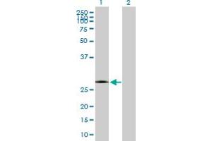 Western Blot analysis of KCTD15 expression in transfected 293T cell line by KCTD15 MaxPab polyclonal antibody. (KCTD15 anticorps  (AA 1-234))