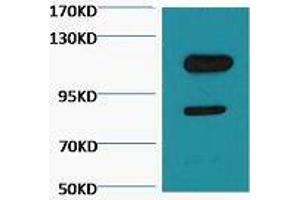 Western Blot (WB) analysis of Jurkat, diluted at 1:3000. (PARP1 anticorps  (cleaved))
