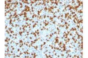 Formalin-fixed, paraffin-embedded human Tonsil stained with PD1 (CD279) Rabbit Recombinant Monoclonal Antibody (PDCD1/1410R). (Recombinant PD-1 anticorps)