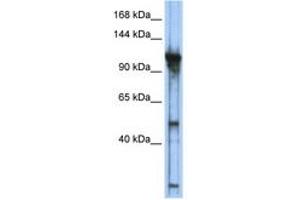 Image no. 1 for anti-General Transcription Factor IIIC, Polypeptide 2, beta 110kDa (GTF3C2) (AA 755-804) antibody (ABIN6742236) (GTF3C2 anticorps  (AA 755-804))