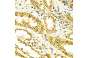Immunohistochemistry of paraffin-embedded Human kidney using LMNB1 antibody at dilution of 1:100 (x400 lens).