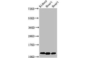 Western Blot Positive WB detected in: Rat kidney tissue, Rat heart tissue, Mouse heart tissue All lanes: CYCS antibody at 2 μg/mL Secondary Goat polyclonal to rabbit IgG at 1/50000 dilution Predicted band size: 12 kDa Observed band size: 12 kDa