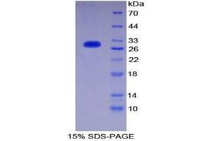 SDS-PAGE analysis of Mouse CD1d Protein. (CD1d Protéine)