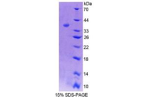 SDS-PAGE analysis of Mouse TR2 Protein. (NR2C1 Protéine)