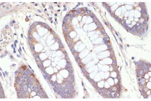 Immunohistochemistry of paraffin-embedded Human colon using HMGCR Polyclonal Antibody at dilution of 1:200 (40x lens). (HMGCR anticorps)