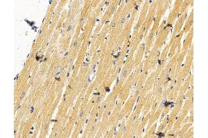 ENTPD6 Antibody at 1/100 staining rat heart tissue by IHC-P. (ENTPD6 anticorps)