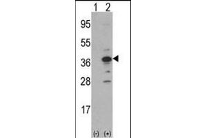 Western blot analysis of MCA1(arrow) using rabbit polyclonal MCA1 Antibody (N-term) (ABIN390679 and ABIN2840973). (MCA1 anticorps  (C-Term))