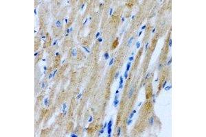 Immunohistochemical analysis of Myomegalin staining in rat heart formalin fixed paraffin embedded tissue section.