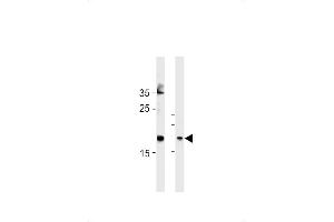 FA Antibody (Center) (ABIN1881332 and ABIN2843378) western blot analysis in Hela cell line and mouse bladder tissue lysates (35 μg/lane). (FAM159A anticorps  (AA 89-115))