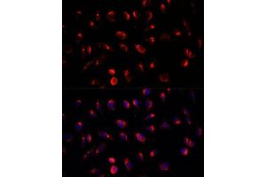 Immunofluorescence analysis of L929 cells using G antibody (ABIN6133219, ABIN6140940, ABIN6140941 and ABIN6222644) at dilution of 1:100.