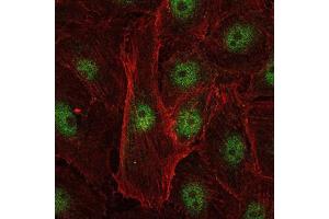 Immunofluorescence analysis of U251 cells using c-Rel mouse mAb (green). (c-Rel anticorps)