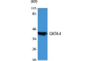 Western Blot (WB) analysis of specific cells using GATA-4 Polyclonal Antibody.