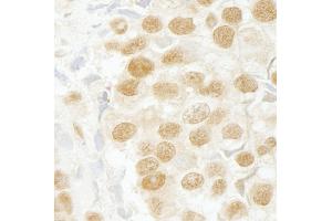 anti-SR-Related CTD-Associated Factor 11 (SCAF11) (C-Term) antibody