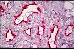 Human Kidney, Tubules: Formalin-Fixed, Paraffin-Embedded (FFPE) (GPR101 anticorps  (C-Term))
