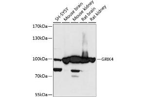 Western blot analysis of extracts of various cell lines, using GRIK4 antibody (ABIN6127977, ABIN6141396, ABIN6141397 and ABIN6217924) at 1:3000 dilution. (GRIK4 anticorps  (AA 21-220))