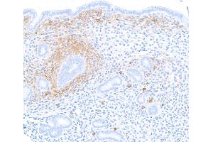 Immunohistochemistry (IHC) image for anti-Syndecan 1 (SDC1) (AA 23-251) antibody (ABIN7795739)