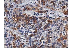 Image no. 2 for anti-Transforming, Acidic Coiled-Coil Containing Protein 3 (TACC3) antibody (ABIN1498095) (TACC3 anticorps)