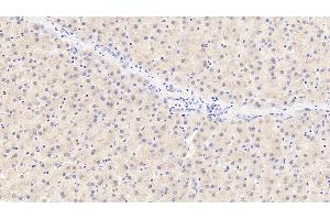 Detection of TYR in Porcine Liver Tissue using Polyclonal Antibody to Tyrosinase (TYR)