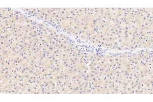 Detection of TYR in Porcine Liver Tissue using Polyclonal Antibody to Tyrosinase (TYR) (TYR anticorps  (AA 5-245))