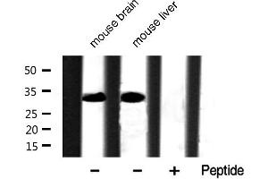 Western blot analysis of extracts of various tissue sample,using Phospho-Caspase 3 (Ser150) Antibody . (Caspase 3 anticorps  (pSer150))
