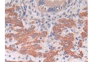 Detection of TXNIP in Mouse Uterus Tissue using Polyclonal Antibody to Thioredoxin-interacting Protein (TXNIP)