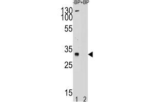 Western Blotting (WB) image for anti-Testis Specific Protein, Y-Linked 1 (TSPY1) antibody (ABIN2995165)