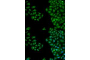 Immunofluorescence analysis of HeLa cells using NEFL antibody. (NEFL anticorps)