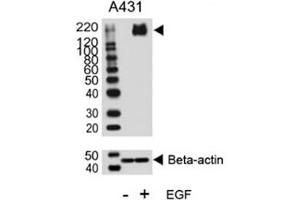 Western blot analysis of lysate from A431 cell line, untreated or treated with EGF (100ng/ml), using phospho-ErbB2 antibody.