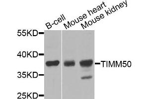 Western blot analysis of extracts of various cells, using TIMM50 antibody. (TIMM50 anticorps)