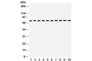 Western blot testing of 1) rat liver, 2) rat thymus, 3) rat testis, 4) mouse liver, 5) mouse thymus, 6) mouse testis, and human 7) HeLa, 8) MCF7, 9) SW620 and 10) SMMC lysate with GRP75 antibody.