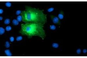 Anti-PFKP mouse monoclonal antibody (ABIN2455340) immunofluorescent staining of COS7 cells transiently transfected by pCMV6-ENTRY PFKP (RC200673). (PFKP anticorps)