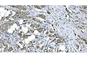 IHC analysis of eRF1/ETF1 using anti-eRF1/ETF1 antibody (ABIN7602625). (ETF1 anticorps  (AA 9-342))