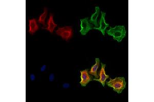 ABIN6266014 and ABIN6273185 staining Hela cells by IF/ICC.