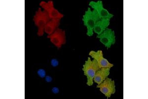 ABIN7096855 and ABIN7100921 staining HepG2 cells by IF/ICC.