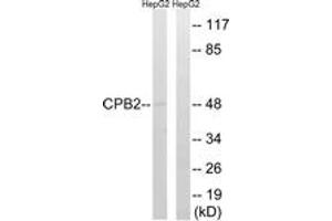 Western blot analysis of extracts from HepG2 cells, using CPB2 Antibody. (CPB2 anticorps  (AA 321-370))