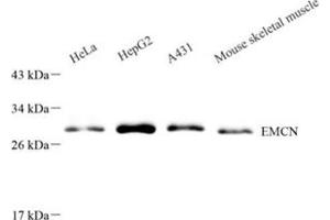 Western blot analysis of EMCN (ABIN7073818) at dilution of 1: 500 (Endomucin anticorps)