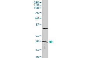DLX6 MaxPab rabbit polyclonal antibody.