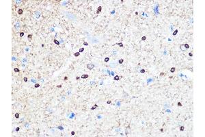 Immunohistochemistry of paraffin-embedded rat brain using Stathmin 1 Rabbit mAb (ABIN1678518, ABIN3018873, ABIN3018874 and ABIN7101680) at dilution of 1:100 (40x lens).