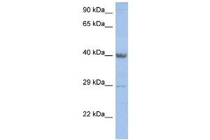 WB Suggested Anti-ZNF474 Antibody Titration: 0. (ZNF474 anticorps  (Middle Region))