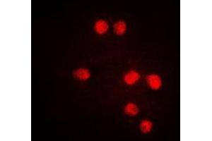 Immunofluorescent analysis of TEL staining in Jurkat cells. (ETV6 anticorps  (C-Term))