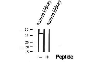 Western blot analysis of extracts from mouse kidney, using ASBT antibody.