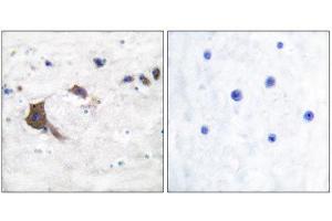 Immunohistochemistry (IHC) image for anti-Hydroxysteroid (17-Beta) Dehydrogenase 10 (HSD17B10) (Internal Region) antibody (ABIN1848526) (HSD17B10 anticorps  (Internal Region))