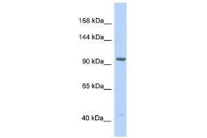 Western Blot showing IDE antibody used at a concentration of 1. (IDE anticorps  (N-Term))