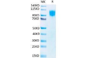 Biotinylated Human PDGF R beta on Tris-Bis PAGE under reduced conditions.