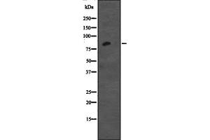 Western blot analysis of CDH12 expression in Jurkat cell lysate,The lane on the left is treated with the antigen-specific peptide. (Cadherin 12 anticorps  (Internal Region))