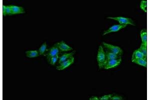 Immunofluorescent analysis of HepG2 cells using ABIN7172328 at dilution of 1:100 and Alexa Fluor 488-congugated AffiniPure Goat Anti-Rabbit IgG(H+L) (TANK anticorps  (AA 4-98))