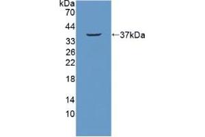 Figure. (NUP214 anticorps  (AA 601-868))