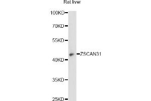 Western blot analysis of extracts of rat liver, using ZSCAN31 antibody (ABIN6294106) at 1:3000 dilution. (ZKSCAN2 anticorps)
