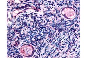 Immunohistochemical (Formalin/PFA-fixed paraffin-embedded sections) staining in human ovary (oocytes) with TMEM5 polyclonal antibody . (TMEM5 anticorps)